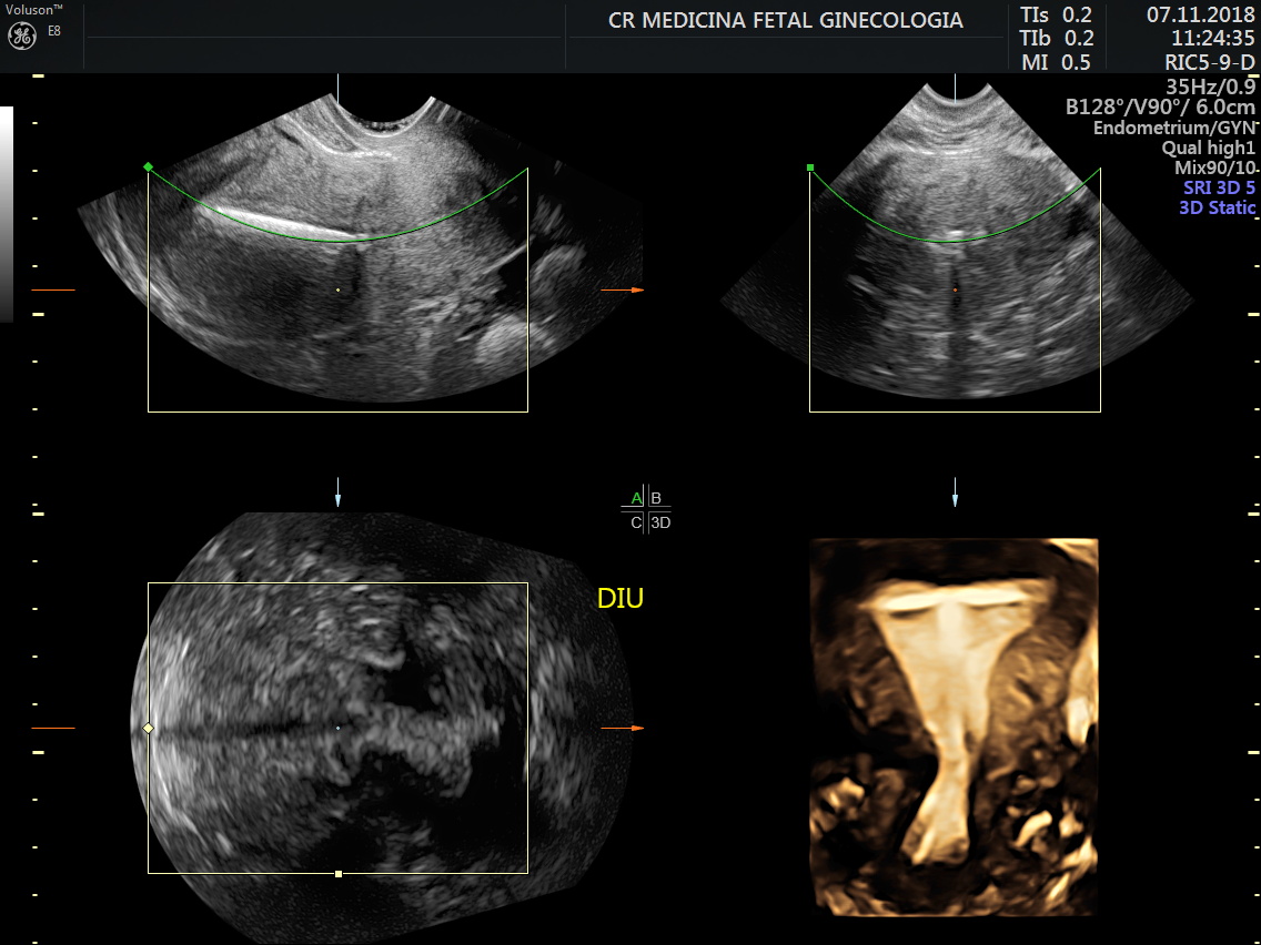 Ultrassonografia Ginecol Gica Cr Medicina Fetal