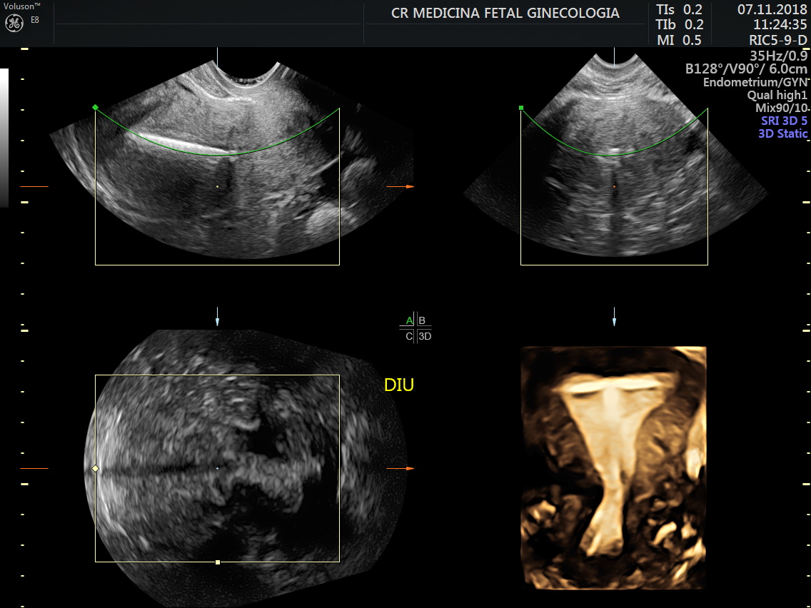 Ultrassonografia Ginecológica Cr Medicina Fetal 