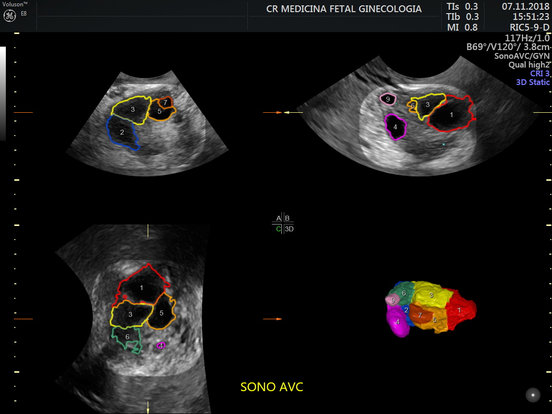 Ultrassonografia Ginecológica CR Medicina Fetal
